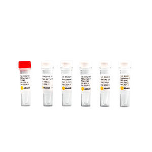 reverse transcriptase reagent