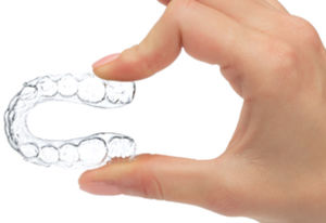 transparent dental aligner