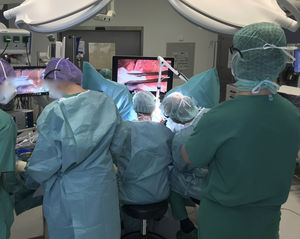 video colposcope