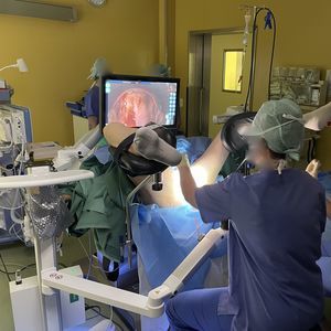 video colposcope