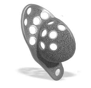 acetabular reinforcement