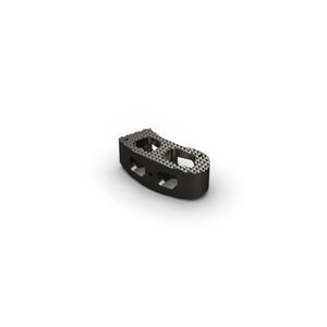 thoraco-lumbar interbody fusion cage 1