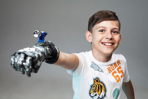 body-powered hand prosthesis