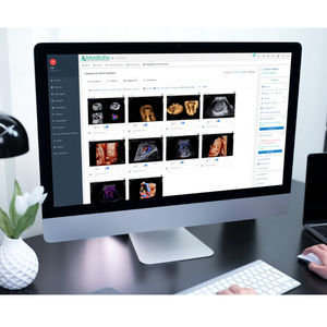 ultrasound imaging software