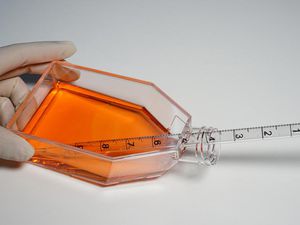 tissue culture flask