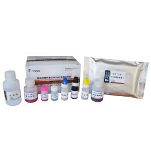 tuberculosis test kit