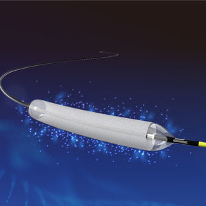 dilatation catheter 1