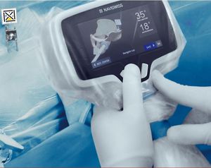orthopedic surgery surgical navigation system