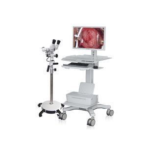digital colposcope 1