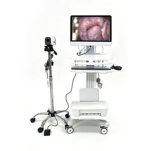 video colposcope