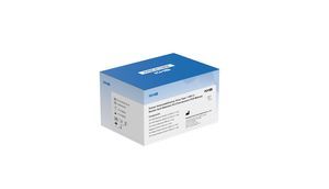 HIV detection kit 1
