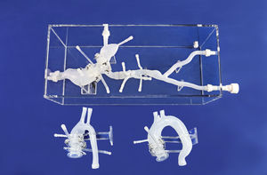 Iliac artery vascular model - All medical device manufacturers