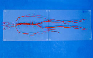 whole body vascular model 1