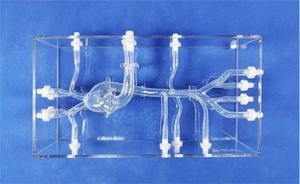 celiac trunk vascular model 1
