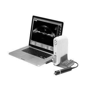 portable ultrasound system