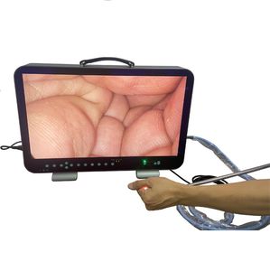 endoscope camera