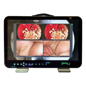 endoscope video camera
