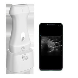 hand-held ultrasound system