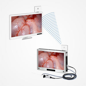 Endoscope camera - IO20260 - Guangdong Softlink Innovation Medical -  digital / full HD / CMOS