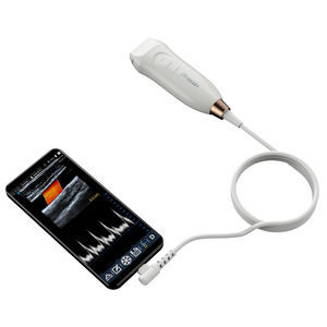 hand-held ultrasound system