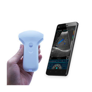 hand-held ultrasound system