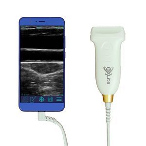hand-held veterinary ultrasound system