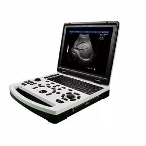 portable ultrasound system 1