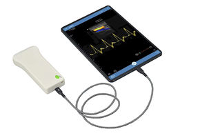 hand-held ultrasound system