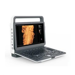 portable ultrasound system 1