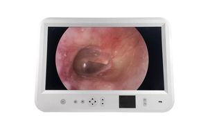 EUS endoscopic imaging system