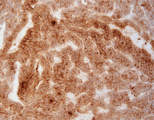 antibody 1