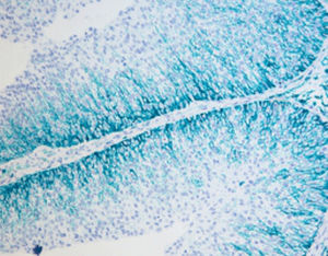 stain reagent kit 1