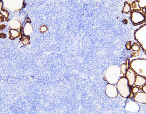 monoclonal antibody 1