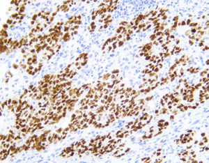 antibody 1