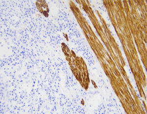 antibody 1
