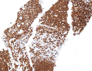 staining solution reagent 1