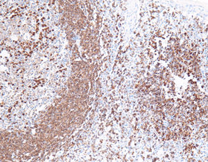 staining solution reagent 1