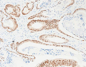 staining solution reagent 1