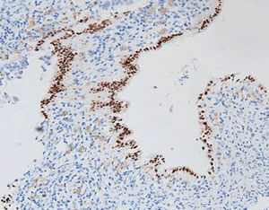 antibody