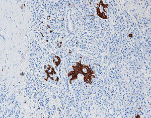 staining solution reagent 1