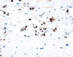 staining solution reagent 1