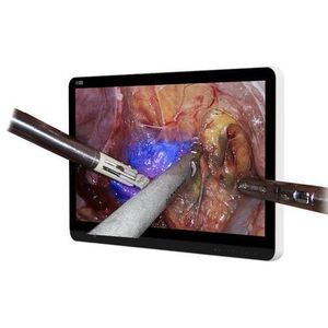 operating room display 1