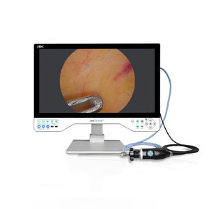 endoscope camera 1