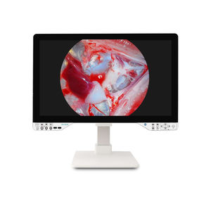 endoscope camera 1