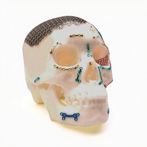 non-absorbable cranial fixation system