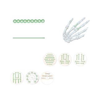 hand phalange compression plate