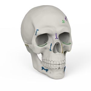 non-absorbable cranial fixation system 1