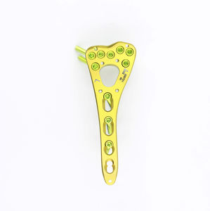 radius compression plate