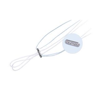 acromioclavicular joint reconstruction suture button 1