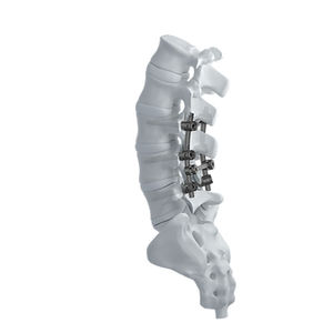 lumbar osteosynthesis unit